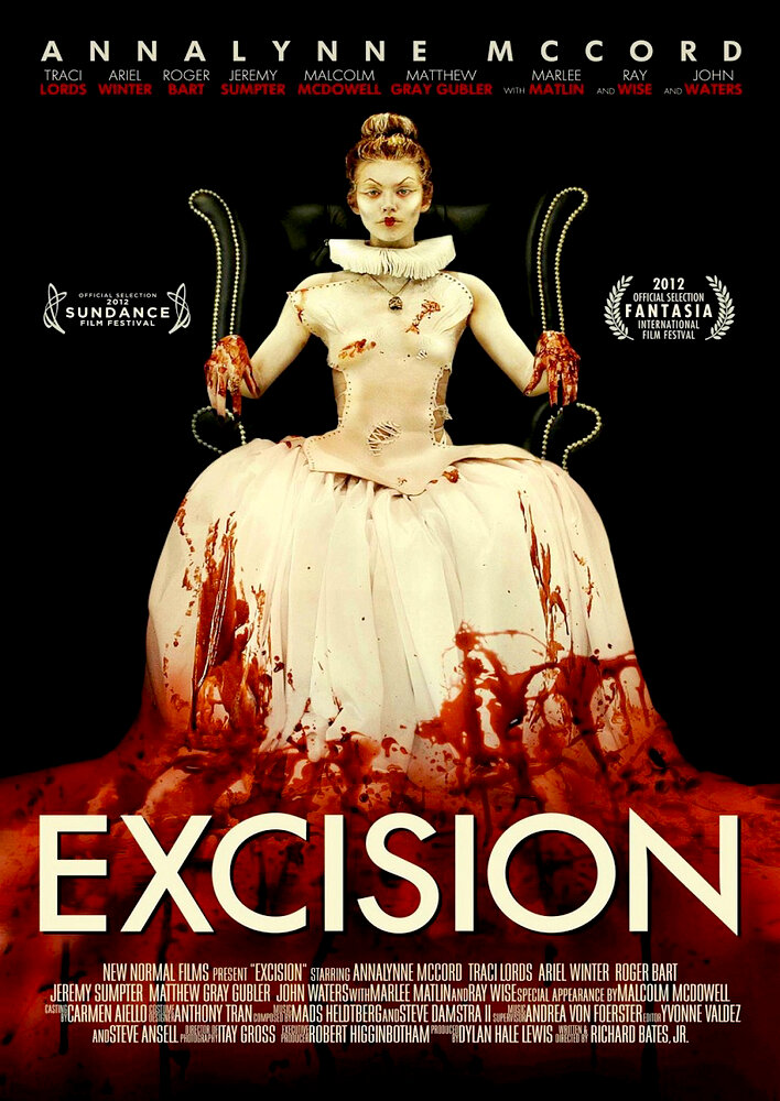 Excision