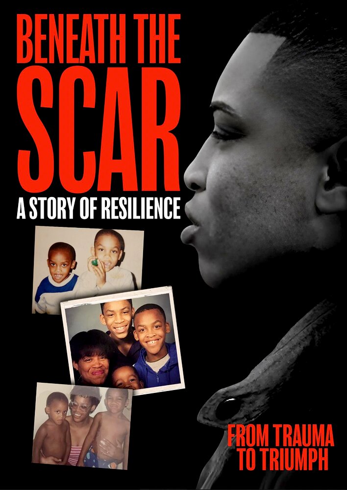 Beneath the Scar: A Story of Resilience
