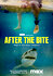 After the Bite