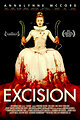 Excision