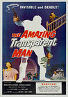 The Amazing Transparent Man